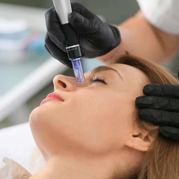 Dermapen Microneedling
