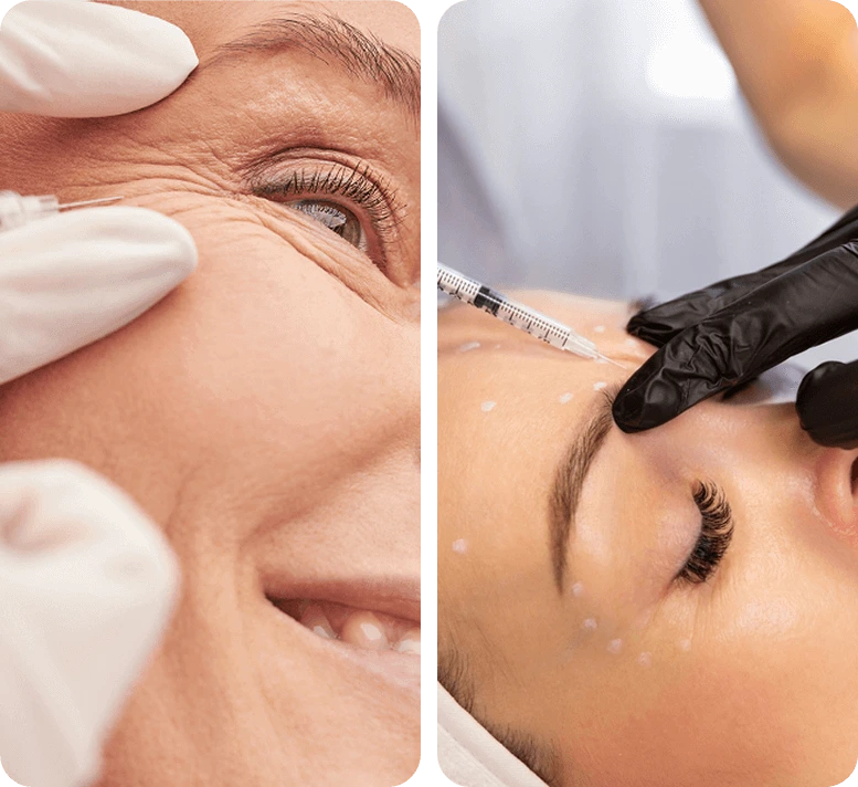 Botox Treatment for Wrinkles